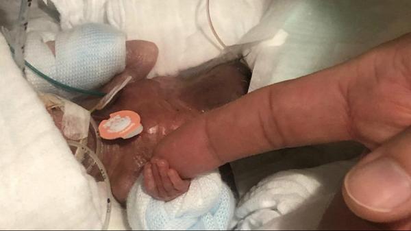 کوچکترین نوزاد پسر دنیا، سالم از بیمارستان مرخص شد